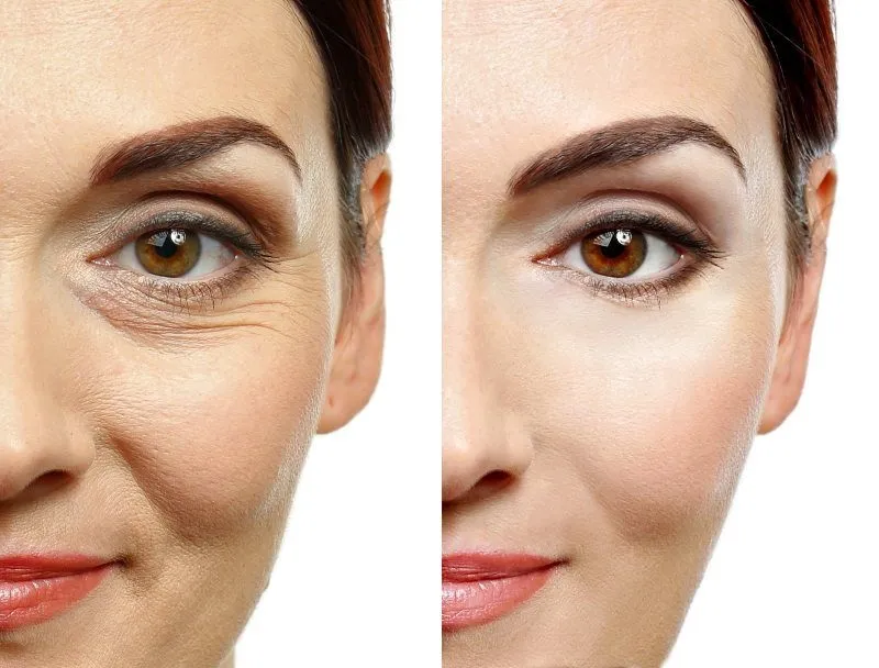 Beauty age cream koupit v lékárně, cena léků, recenze, účinek.