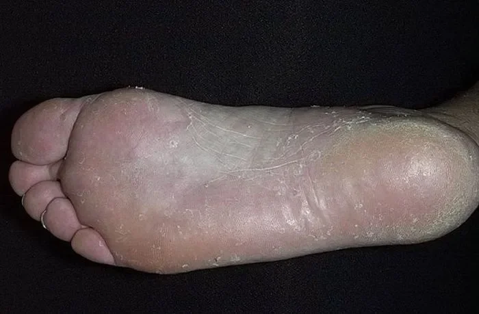 Softisenil : složení pouze přírodní složky.