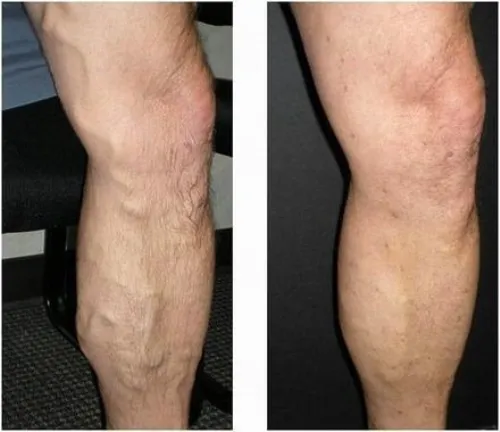 Wintex ultra gel : složení pouze přírodní složky.